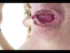 Fist and Gape with a Dog