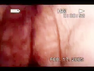 Hairy and Submissive Woman at the Mercy of a Dog