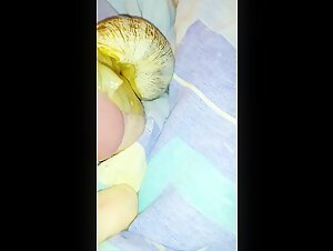 Naughty snail: an unexpected encounter