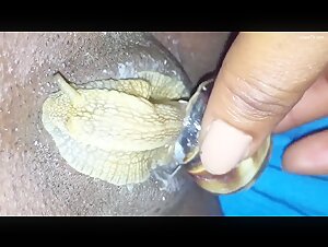 Snail and woman: an unexpected encounter